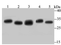 Proteasome 20S C2 Rabbit anti-Human, Mouse, Rat, Clone: JB89-30, Novus